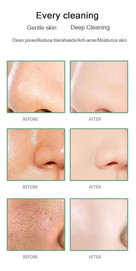 Green Tea Cleansing Mask Stick Blackhead Remover