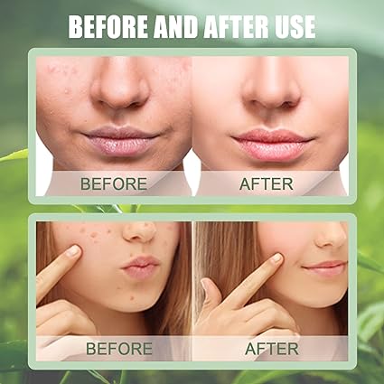 Green Tea Cleansing Mask Stick Blackhead Remover